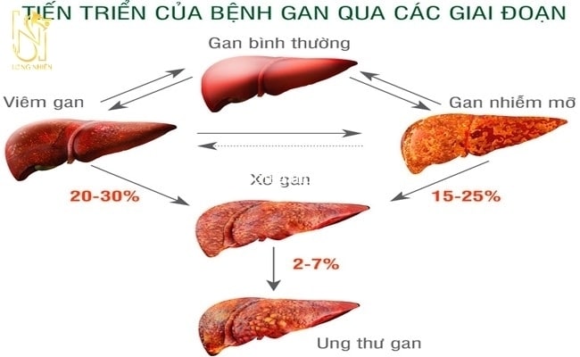 MẸO THẢI ĐỘC CƠ THỂ ĐƠN GIẢN TẠI NHÀ BẰNG PHƯƠNG PHÁP TỰ NHIÊN ?