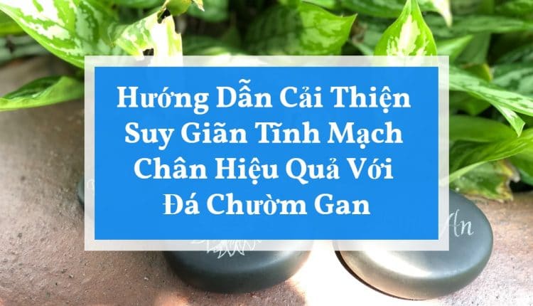 huong-dan-cai-thien-suy-gian-tinh-mach-chan-hieu-qua-voi-da-chuom-gan